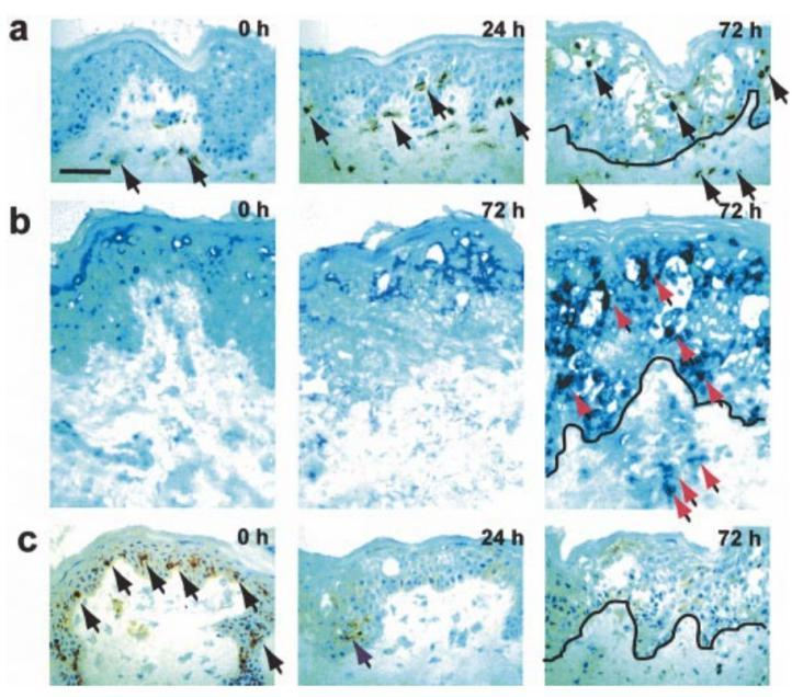 人体皮肤经 4 倍最小红斑剂量 UVB 照射后 CD11b+ 单核巨噬细胞增多、IL-10 表达增多、CD1a+ 朗格汉斯细胞减少的免疫组化染色对比